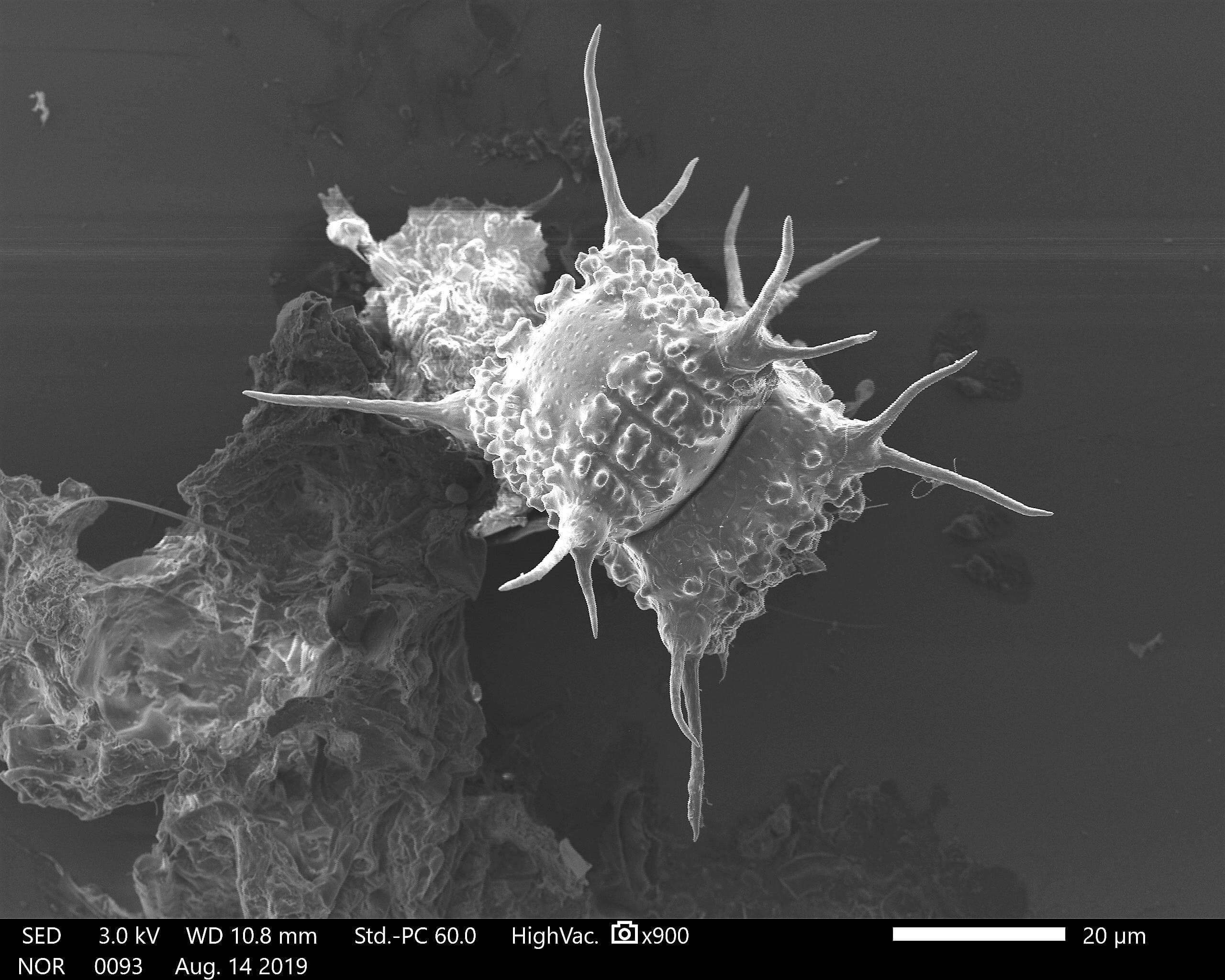 Lake Annie alga, Staurastrum_novae-caesare. SEM photo by Kristy Sullivan (FIU)